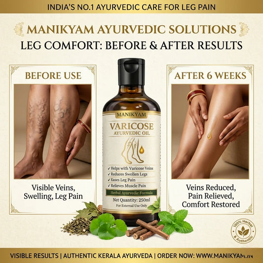 VARICOSE VEINS PAIN RELIEF OIL - Ayurveda Oil Relief 60 Days Challenge