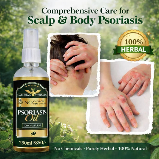 Garuda Herbal Psoriasis Oil-Advanced Psoriasis Clearing Oil With Powder