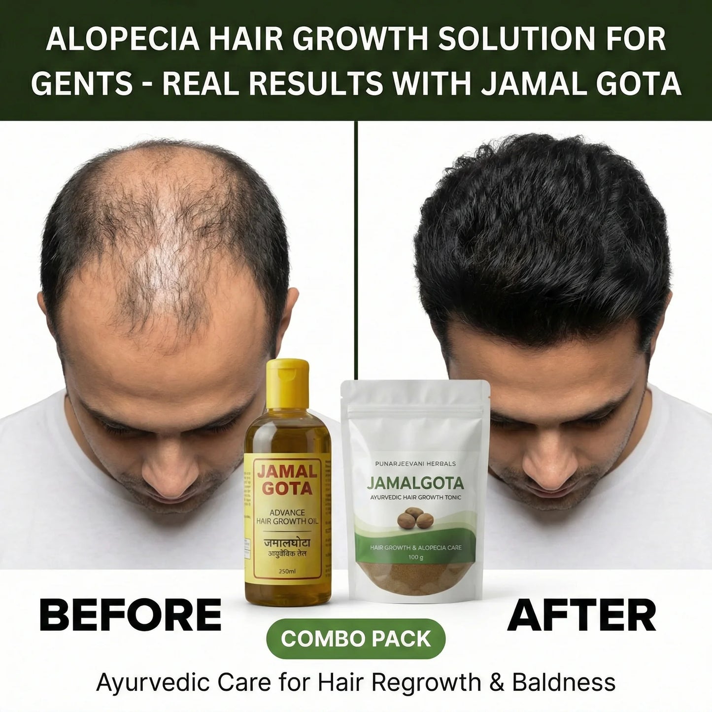 Advanced Jamalgota Herbal Hair Oil-100% Intense Hair Care