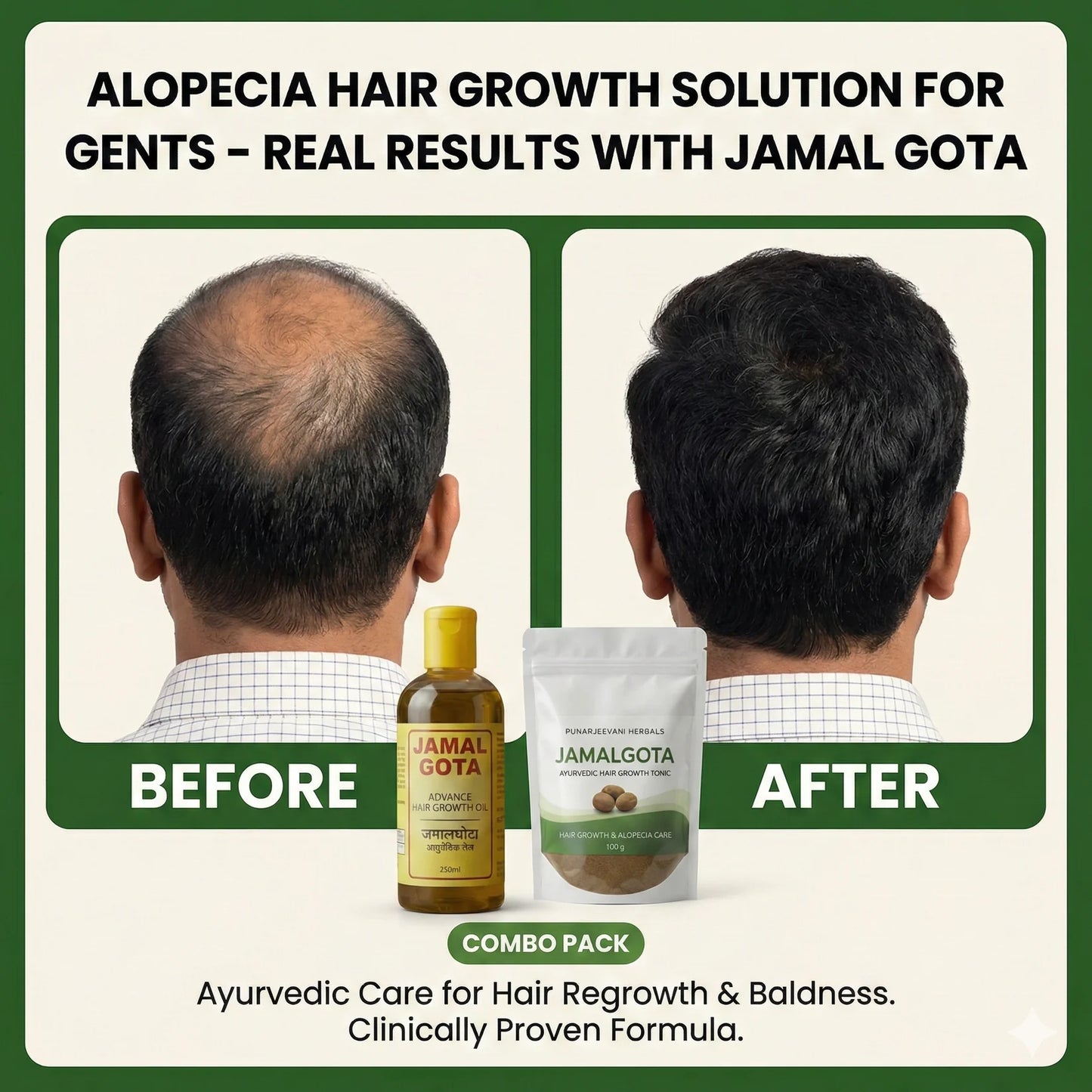 Advanced Jamalgota Herbal Hair Oil-100% Intense Hair Care